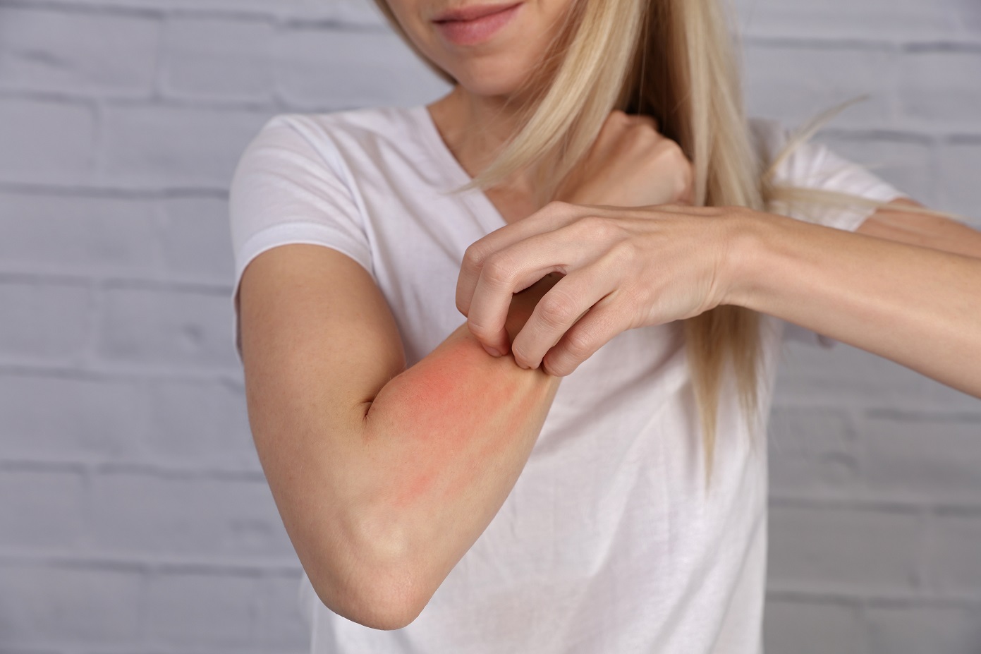Jak se projevuje alergie na kosmetické přípravky? Čtěte obaly